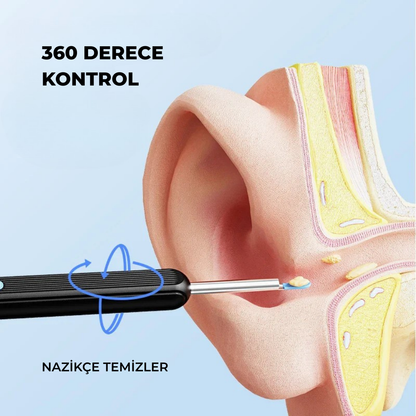 Kameralı Kulak Temizleme Seti